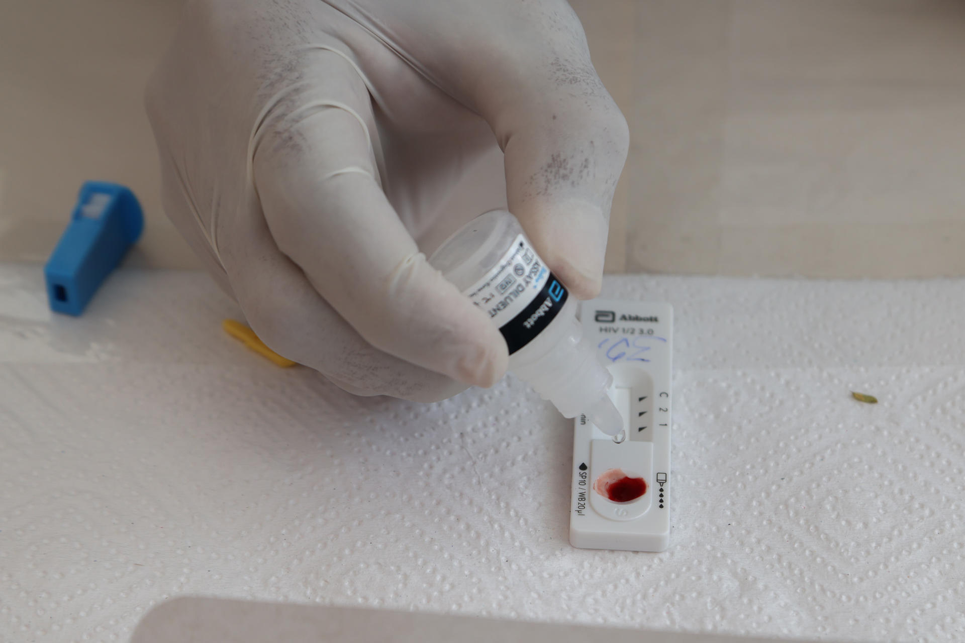 Terapia celular logra controlar el VIH en pacientes de estudio clínico