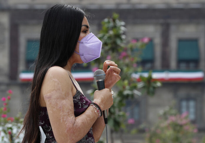 Fotografía de archivo donde aparece la saxofonista mexicana María Elena Ríos, victima de un ataque con ácido. EFE/Mario Guzmán
