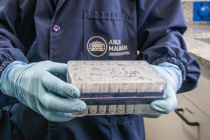Fotografía cedida por ANLIS Malbrán que muestra a una persona sosteniendo una bandeja con tubos de laboratorio en Buenos Aires (Argentina). EFE/ ANLIS Malbrán
