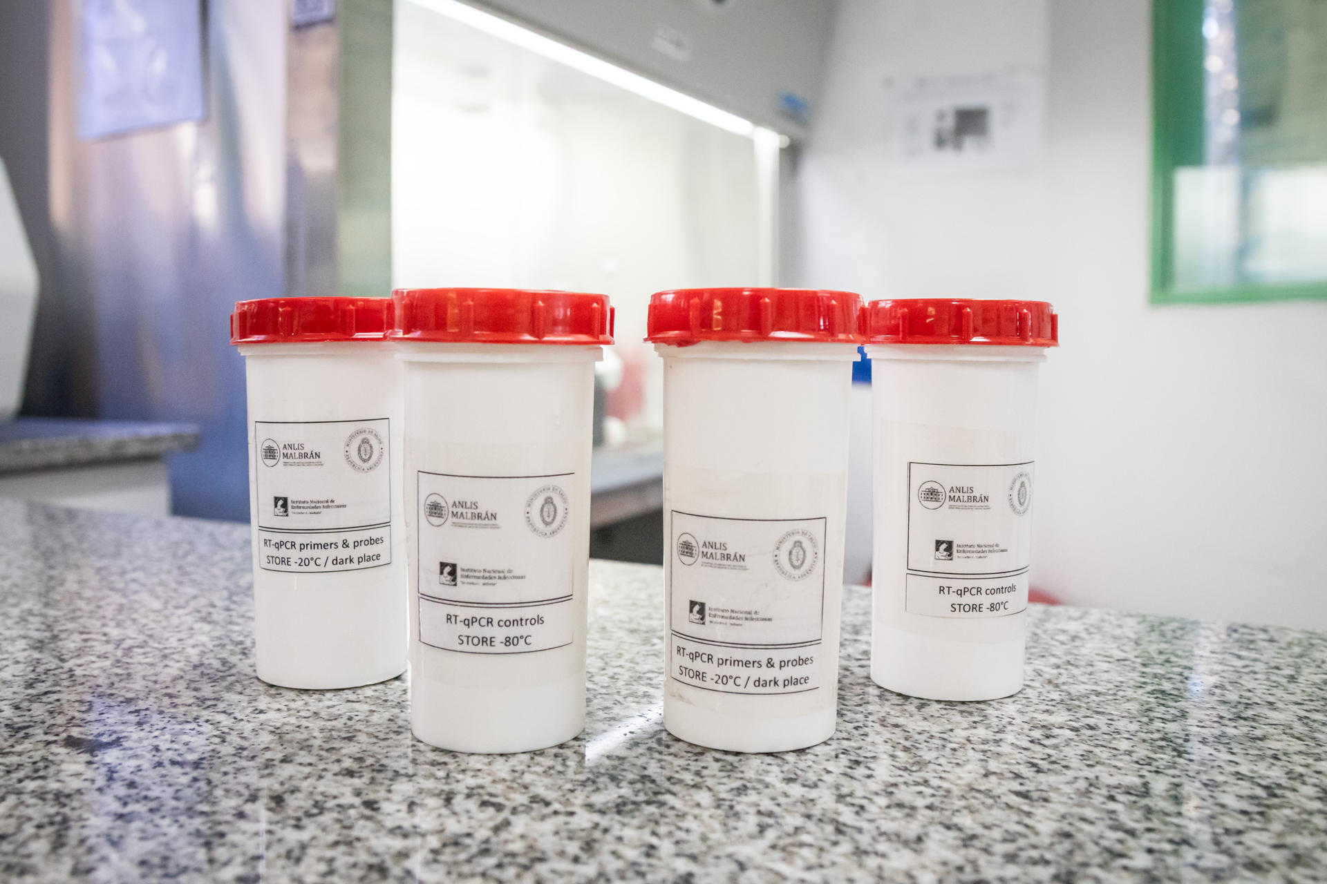 Fotografía cedida por ANLIS Malbrán que muestra recipientes de laboratorio en Buenos Aires (Argentina). EFE/ ANLIS Malbrán
