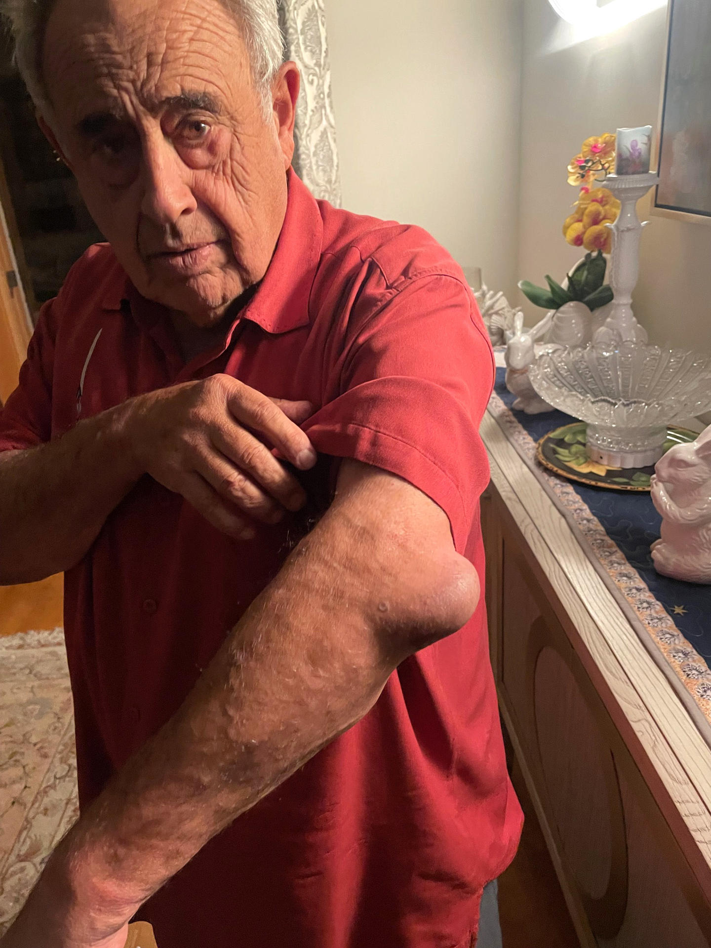 Fotografía cedida por el bufete de abogados V. James DeSimone Law de Rafie Shouhed quien demandó este jueves por 50 millones de dólares al Gobierno del presidente Donald Trump, tras sufrir graves lesiones durante una redada de inmigración realizada en septiembre pasado en su negocio en Los Ángeles (EE.UU.). EFE/ V. James DeSimone Law /SOLO USO EDITORIAL /NO VENTAS /SOLO DISPONIBLE PARA ILUSTRAR LA NOTICIA QUE ACOMPAÑA /CRÉDITO OBLIGATORIO
