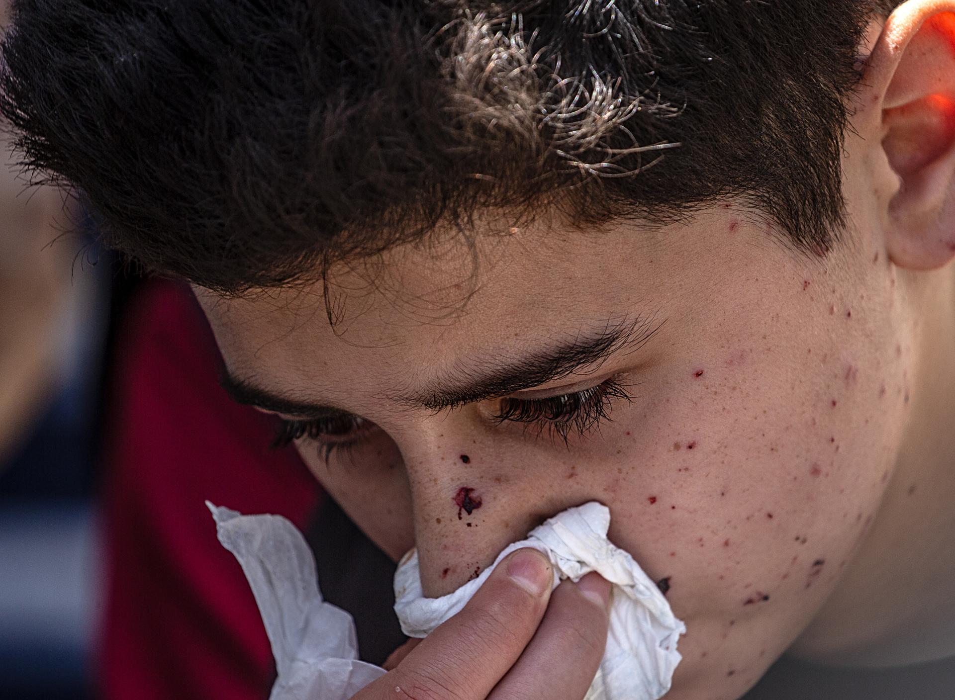 Un niño herido, hijo de Abdallah Abu Kaloub, llora cerca de los cuerpos cubiertos de su padre y su esposa en el Hospital Al-Shifa en la Ciudad de Gaza, Franja de Gaza, 04 de junio de 2026. La pareja murió durante los ataques aéreos israelíes nocturnos sobre Gaza, que según el Ministerio de Salud palestino mataron al menos a nueve palestinos, incluidos mujeres y niños. EFE/EPA/MOHAMMED SABER

