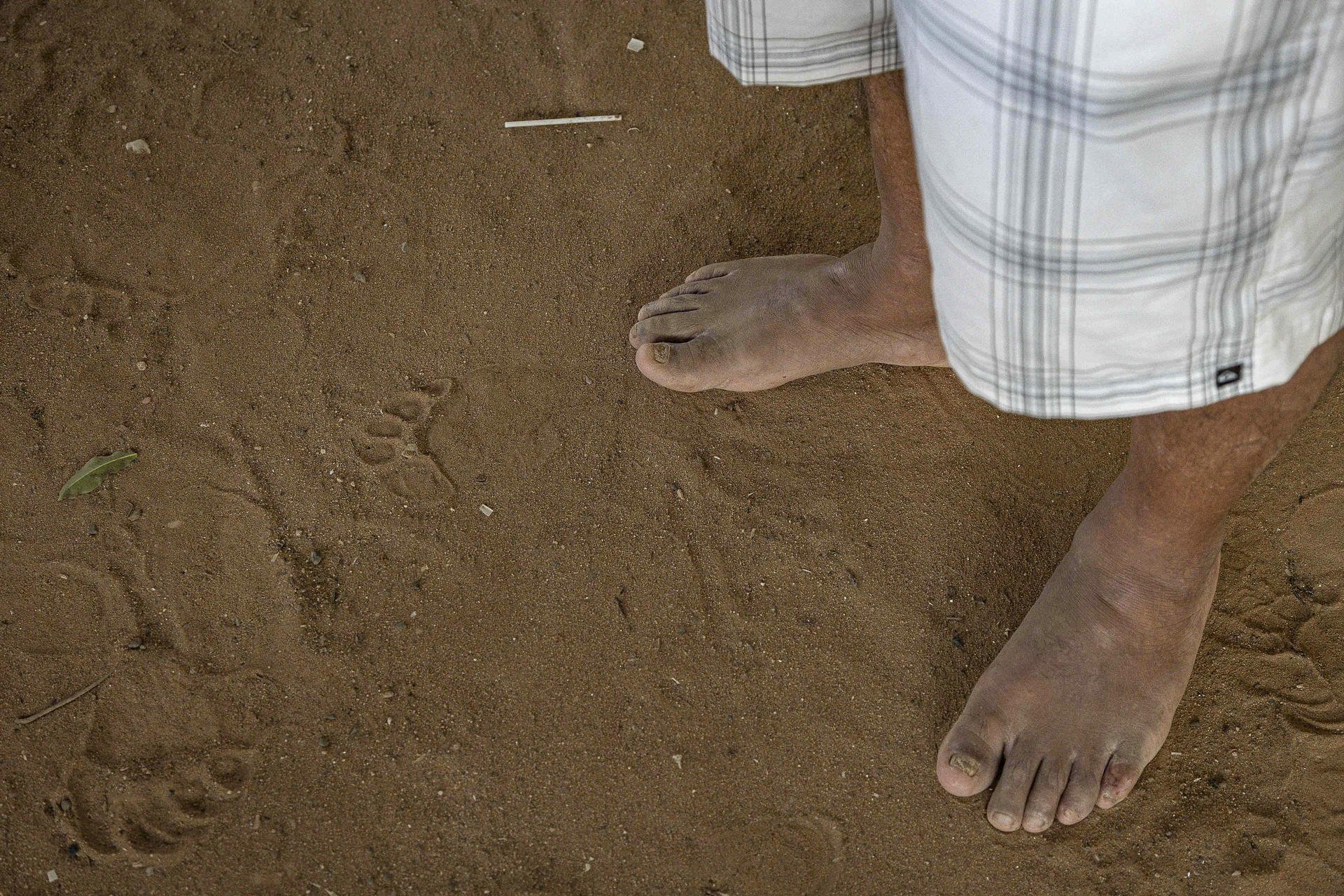 Fotografía que muestra los pies de Uruman Urdaneta este miércoles, en Maracaibo (Venezuela). EFE/Henry Chirinos
