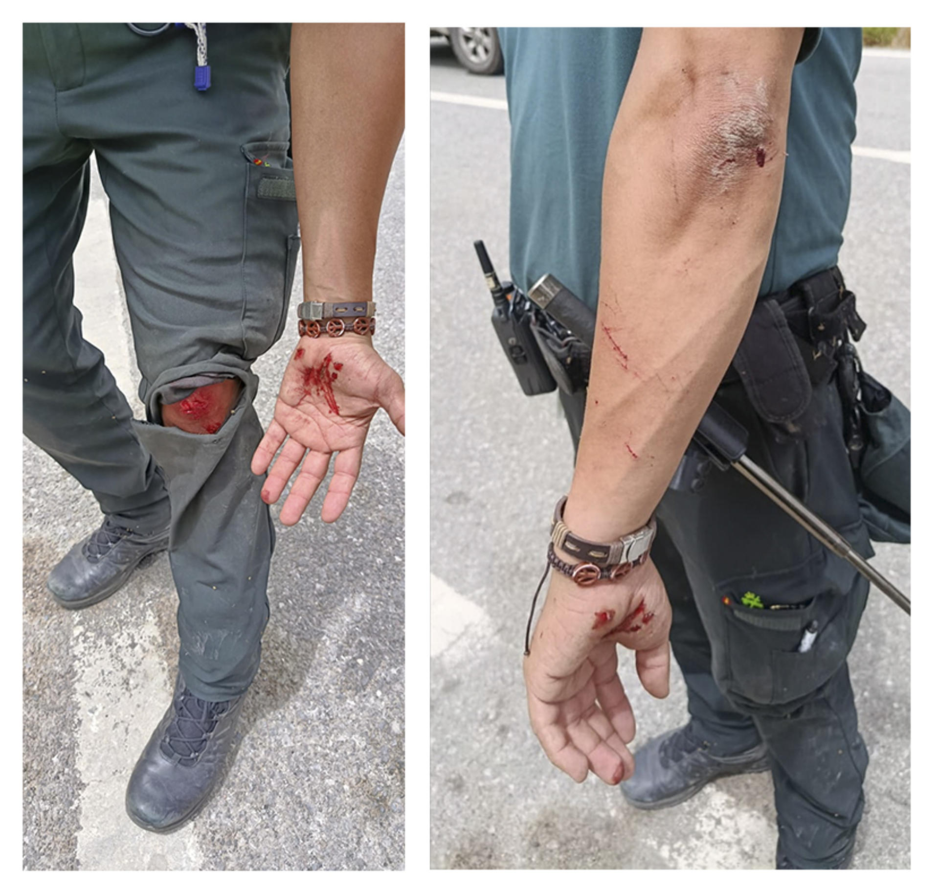 La Asociación Unificada de Guardias Civiles (AUGC) ha reclamado este viernes más “medios humanos y materiales” para el control de la frontera entre Ceuta y Marruecos como consecuencia de la elevada presión migratoria que este jueves provocó que un agente resultara herido al intentar contener la entrada de tres subsaharianos. En un comunicado, la AUGC ha reclamado más medios humanos y materiales para los agentes y ha considerado que las patrullas unipersonales “no son la opción más segura” para afrontar este tipo de intervenciones.-EFE/ Asociación Unificada de la Guardia Civil (AUGC) ***SOLO USO EDITORIAL/SOLO DISPONIBLE PARA ILUSTRAR LA NOTICIA QUE ACOMPAÑA (CRÉDITO OBLIGATORIO)***
